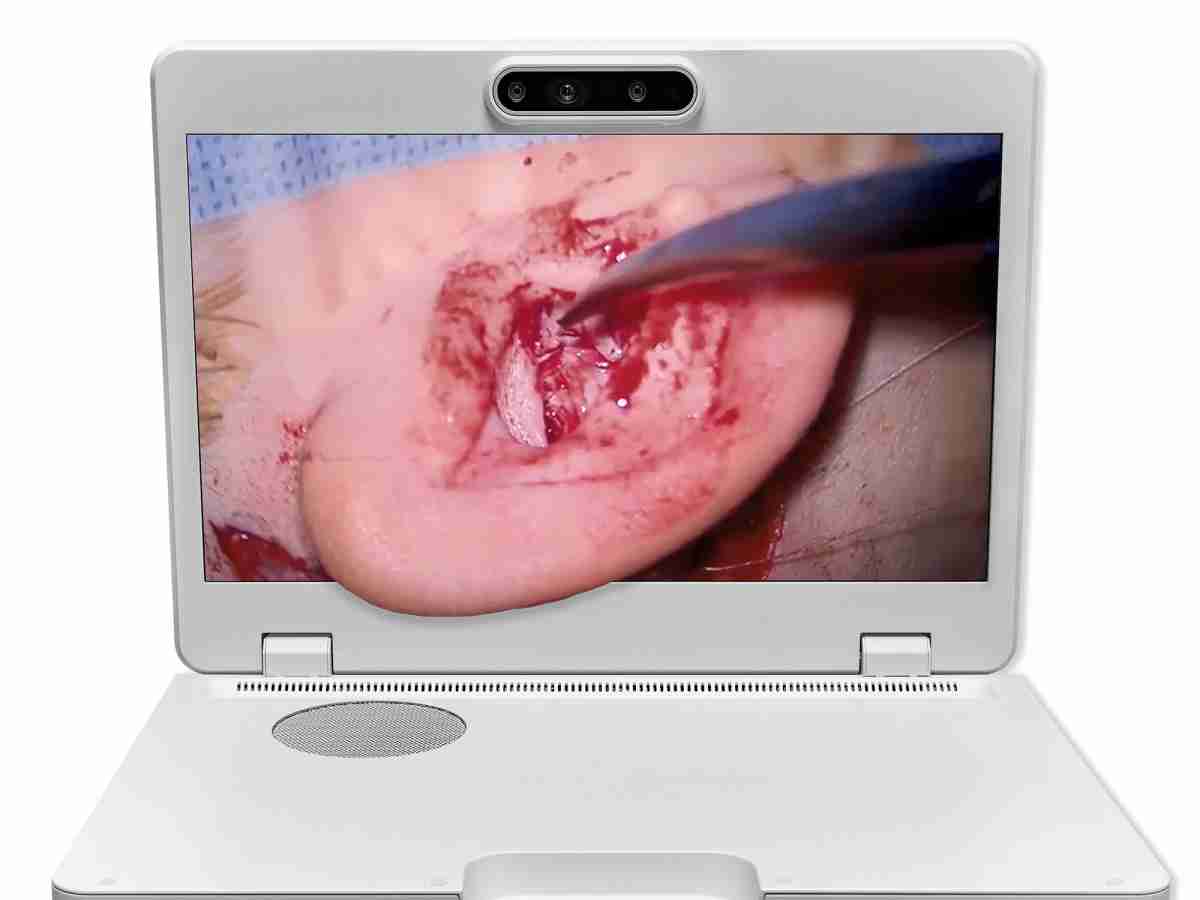 达擎之＂Heads-up 3D显微手术显示系统＂，，，整合4K裸眼3D显示及眼球追踪系统，，具备快速追踪人眼移动位置功能，，，，减轻医师长时间维持固定姿势的负担，，让医师能有更宽广清晰的3D立体视野及更舒适的姿势来执行手术。。